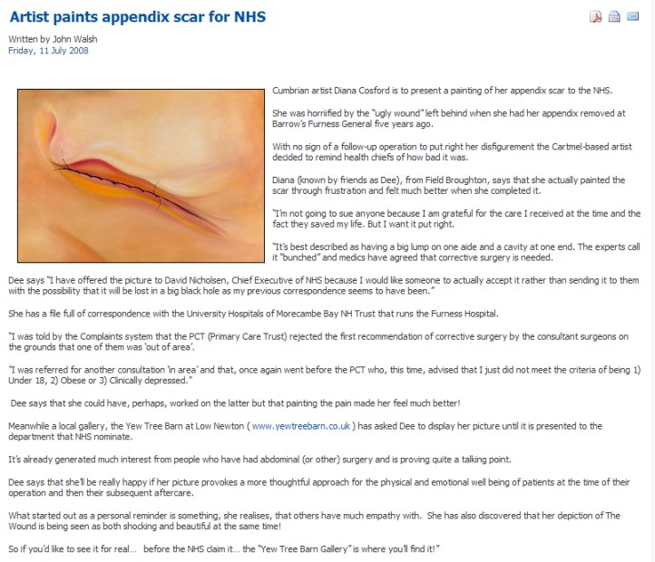 Artist paints appendix scar for NHS